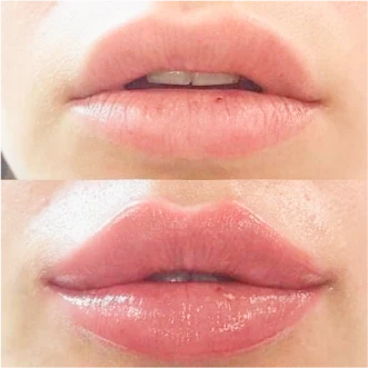 lip tattooing