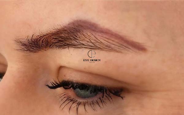 Cosmetic Tattoo Laser Removal Eyebrow